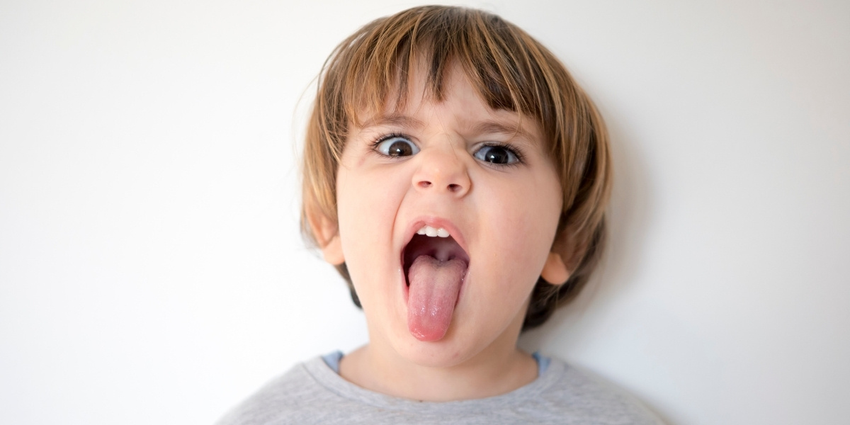 tongue tie